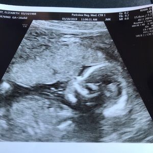 Meet your Posher, Betsy